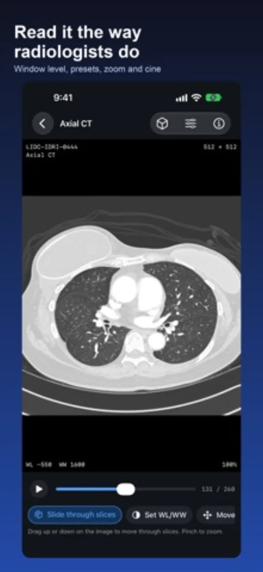 DICOM Viewer screenshot 2