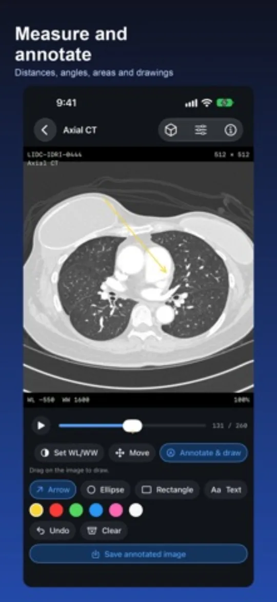 DICOM Viewer screenshot 3