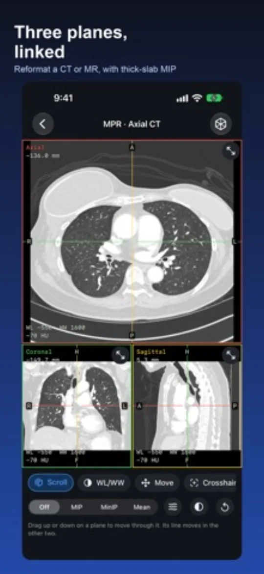 DICOM Viewer screenshot 4