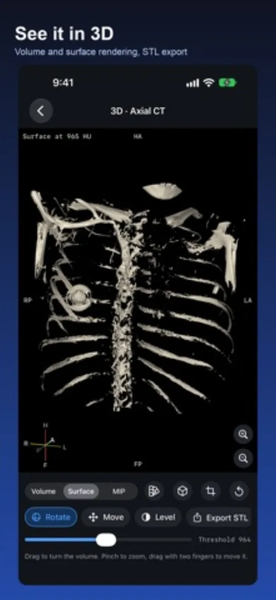 DICOM Viewer screenshot 5